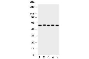Western blot testing of ASIC3 antibody and Lane 1:  rat brain (ASIC3 anticorps  (N-Term))
