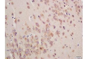 Formalin-fixed and paraffin embedded mouse brain labeled with Rabbit Anti-GSTA3 Polyclonal Antibody, Unconjugated (ABIN755767) at 1:200 followed by conjugation to the secondary antibody and DAB staining (GSTA3 anticorps  (AA 131-222))