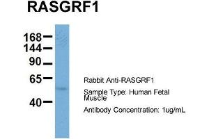 Host: Rabbit  Target Name: RASGRF1  Sample Tissue: Human Fetal Muscle  Antibody Dilution: 1.
