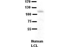 WB Suggested Anti-COL6A1 Antibody Titration:  5% Milk  ELISA Titer:  dilution: 1:500  Positive Control:  human LCL