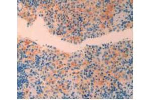 IHC-P analysis of Rat Spleen Tissue, with DAB staining. (CRH anticorps  (AA 39-187))