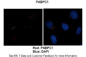 Sample Type :  Human brain stem cells (NT2)   Primary Antibody Dilution :   1:500  Secondary Antibody :  Goat anti-rabbit Alexa Fluor 594  Secondary Antibody Dilution :   1:1000  Color/Signal Descriptions :  Red: PABPC1 Blue: DAPI  Gene Name :  PABPC1  Submitted by :  Dr. (PABP anticorps  (Middle Region))