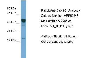 WB Suggested Anti-DYX1C1  Antibody Titration: 0. (DYX1C1 anticorps  (Middle Region))