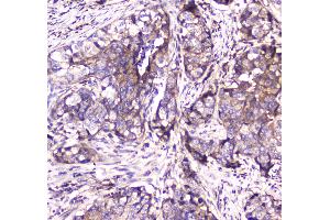 IHC analysis of SDHB using anti-SDHB antibody .