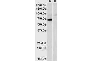 Western Blotting (WB) image for Monoamine Oxidase A (MAOA) peptide (ABIN368822)
