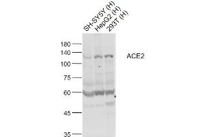 Lane 1: SH-SY5Y cell lysates; Lane 2: HepG2 cell lysates; Lane 3: 293T cell lysates probed with ACE2 Polyclonal Antibody, Unconjugated (bs-23443R) at 1:1000 dilution and 4˚C overnight incubation. (ACE2 anticorps  (AA 451-550))