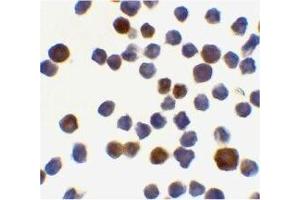 Immunocytochemical staining of K562 cells using Acinus antibody at 0. (ACIN1 anticorps  (C-Term))