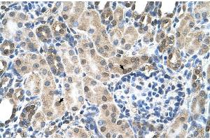 Human kidney (SLC19A1 anticorps  (N-Term))