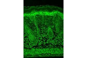 Immunohistochemistry analysis using Mouse Anti-HIF1 alpha Monoclonal Antibody, Clone ESEE122 .