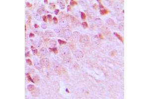 Immunohistochemical analysis of TRAF3IP1 staining in human brain formalin fixed paraffin embedded tissue section.