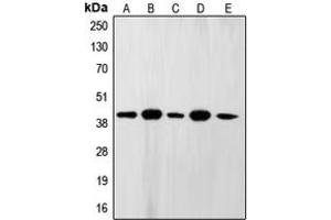 Western blot analysis of FEN1 expression in A431 (A), MCF7 (B), U937 (C), NIH3T3 (D), PC12 (E) whole cell lysates. (FEN1 anticorps  (Center))