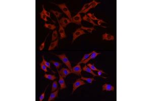 Immunofluorescence analysis of NIH/3T3 cells using S6 Ribosomal Protein (RPS6) Rabbit mAb (ABIN7270026) at dilution of 1:100 (40x lens). (RPS6 anticorps)