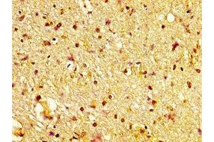 IHC image of ABIN7170335 diluted at 1:600 and staining in paraffin-embedded human brain tissue performed on a Leica BondTM system. (Sortilin 1 anticorps  (AA 328-457))