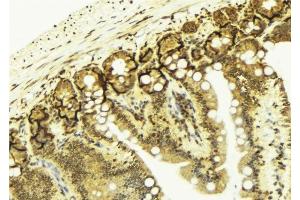 ABIN6276685 at 1/100 staining Mouse colon tissue by IHC-P. (Galectin 3 anticorps  (Internal Region))