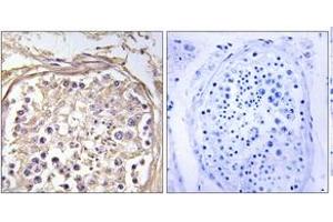Immunohistochemistry (IHC) image for anti-Carbohydrate (N-Acetylgalactosamine 4-0) Sulfotransferase 9 (CHST9) (AA 361-410) antibody (ABIN2890185) (CHST9 anticorps  (AA 361-410))