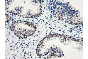 Image no. 7 for anti-Aminoacylase 1 (ACY1) antibody (ABIN1496454) (Aminoacylase 1 anticorps)