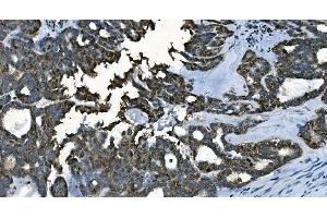 IHC analysis of CDC45L using anti-CDC45L antibody (ABIN7600230). (CDC45 anticorps  (AA 166-431))