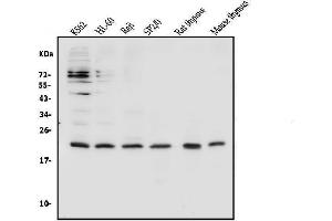 Western blot analysis of CD69 using anti-CD69 antibody (ABIN7599623). (CD69 anticorps  (AA 101-148))