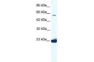 DDX55 antibody used at 1. (DDX55 anticorps)