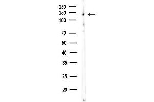 Western blot analysis of lysates from COLO205 cells, using Phospho-TrkB (Tyr706) Antibody at 1/1000 dilution.