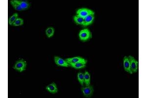 Immunofluorescence staining of HepG2 cells with ABIN7167891 at 1:100, counter-stained with DAPI.