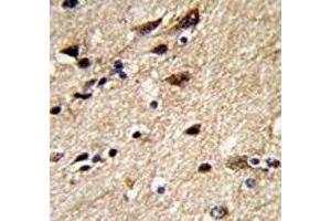 IHC analysis of FFPE human brain stained with b-Tubulin antibody (TUBB1 anticorps)