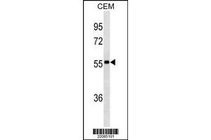 Image no. 1 for Mouse anti-Human IgA (AA 150-178) antibody (ABIN1480665) (Souris anti-Humain IgA (AA 150-178) Anticorps)