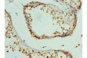 Immunohistochemistry of paraffin-embedded human testis tissue using ABIN7148180 at dilution of 1:100 (CCDC97 anticorps  (AA 1-343))