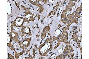 IHC analysis of EPLIN/LIMA1 using anti-EPLIN/LIMA1 antibody (ABIN7602639).