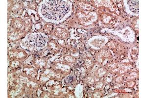 Immunohistochemical analysis of paraffin-embedded human-kidney, antibody was diluted at 1:200 (HMMR anticorps  (AA 280-340))
