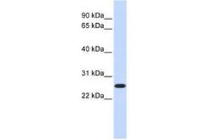 Image no. 1 for anti-CTD Nuclear Envelope Phosphatase 1a (CTDNEP1A) (C-Term) antibody (ABIN6740996) (CTDNEP1A anticorps  (C-Term))