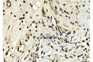 IHC analysis of EXOSC8 using anti-EXOSC8 antibody (ABIN7601850). (EXOSC8 anticorps  (AA 49-216))