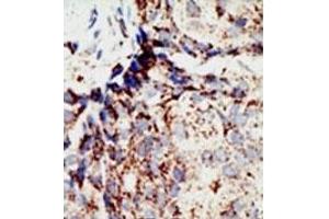 Image no. 1 for anti-BRCA1 Associated Protein-1 (Ubiquitin Carboxy-terminal Hydrolase) (BAP1) (N-Term) antibody (ABIN357594) (BAP1 anticorps  (N-Term))
