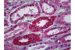 Anti-CACNA2D2 antibody IHC of human kidney, tubules.