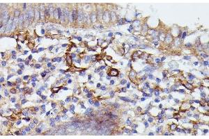 Immunohistochemistry of paraffin-embedded Human appendix using SNAP23 Polyclonal Antibody at dilution of 1:100 (40x lens).