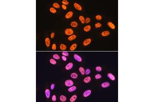 Immunofluorescence analysis of U-2 OS cells using hnRNP K Rabbit mAb (ABIN7267634) at dilution of 1:100 (40x lens). (HNRNPK anticorps)