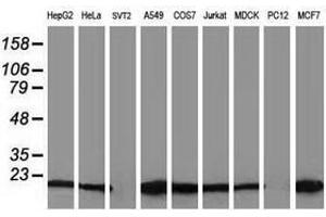 Image no. 13 for anti-Destrin (Actin Depolymerizing Factor) (DSTN) antibody (ABIN1497907)