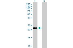 Western Blot analysis of IFNK expression in transfected 293T cell line by IFNK MaxPab polyclonal antibody. (IFNK anticorps  (AA 1-207))