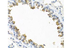 Immunohistochemistry of paraffin-embedded Mouse lung using TICAM1 Polyclonal Antibody at dilution of 1:100 (40x lens). (TICAM1 anticorps)