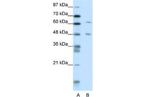 WB Suggested Anti-NAB2 Antibody Titration:  1. (NAB2 anticorps  (N-Term))