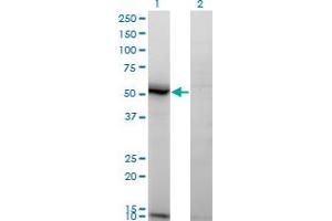 Western Blot analysis of ASAH1 expression in transfected 293T cell line by ASAH1 monoclonal antibody (M02), clone 1A7. (ASAH1 anticorps  (AA 25-124))