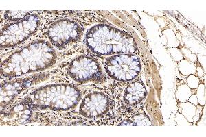 Detection of IFNb in Human Colon Tissue using Monoclonal Antibody to Interferon Beta (IFNb)