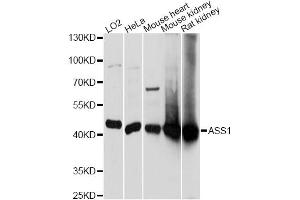 Western blot analysis of extracts of various cell lines, using ASS1 antibody. (ASS1 anticorps)