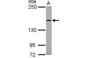WB Image Sample (30 ug of whole cell lysate) A: 293T 5% SDS PAGE antibody diluted at 1:1000 (SEMA4D/CD100 anticorps)