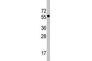 Western blot analysis of CDC6 antibody in Ramos lysate.