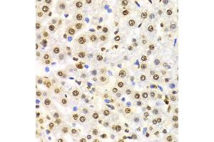 Immunohistochemistry of paraffin-embedded Rat liver using TriMethyl-Histone H3-K9 antibody. (Histone 3 anticorps  (H3K9me3))