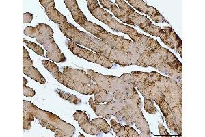 IHC analysis of TNNI1 using anti-TNNI1 antibody (ABIN7603242). (TNNI1 anticorps  (N-Term))