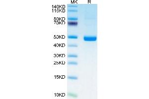 Human PSMP on Tris-Bis PAGE under reduced condition.