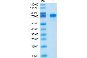 SDS-PAGE (SDS) image for CD274 (PD-L1) (AA 19-238) protein (Fc Tag) (ABIN7275430)