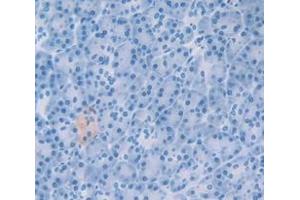 IHC-P analysis of Human Tissue, with DAB staining. (GDF15 anticorps  (AA 195-308))